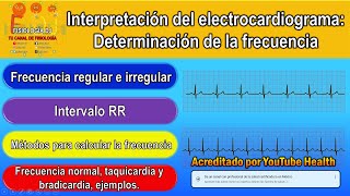 Electrocardiograma interpretación  Electrocardiograma  Determinación de la frecuencia  Ejemplos [upl. by Castorina]