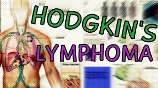 Hodgkins Lymphoma  Types  Symptoms  Staging  Treatment  Diagnosis Hodgkins Lymphoma Explained [upl. by Irakuy]