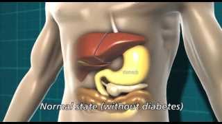 Diabetes and the body  Diabetes UK [upl. by Tawnya486]