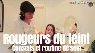 Rougeurs du teint  conseils et routine de soin  maquillage [upl. by Wylde]