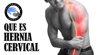 Hernia de disco cervical o hernia discal cervical que es y porque se produce [upl. by Inait]