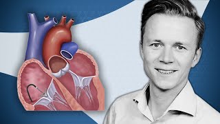 Hemodynamic implications of TTVI on right heart function  Tricuspid Focus Group [upl. by Llezniuq]