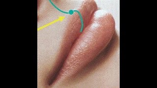 Different Types of Lip Injections [upl. by Tnecnivleahcim]