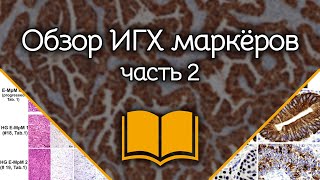 Общий обзор иммуногистохимических маркёров Часть 2 [upl. by Jake]