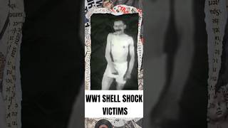 Shell Shock Victims From WW1 🪖 shorts war strangehistory [upl. by Nolyaj]