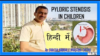 पायलोरिक स्टेनोसिस  पूरी जानकारी  PYLORIC STENOSIS IN CHILDREN HINDI [upl. by Arhoz678]