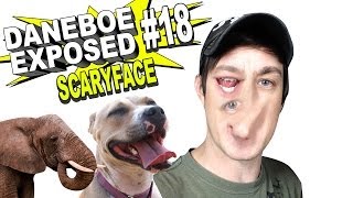 Daneboe Exposed 18 SCARYFACE [upl. by Smitty]