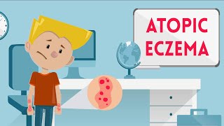 Atopic Eczema [upl. by Etteyniv]