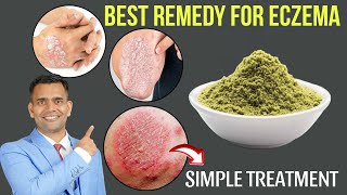 Best Natural Treatment For Eczema  How To Get Rid Of Eczema Naturally  Dr Vivek Joshi [upl. by Eicyal]