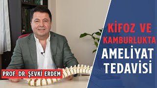 Kifoz ve Kamburluk Ameliyatları  İyileşme Süreçleri  Prof Dr Şevki Erdem [upl. by Loats]