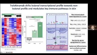 Dr GuttmanTargeing IL13 with tralokinumab normalizes type 2 inflammation in AD [upl. by Caraviello]