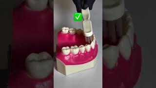 tooth teethcleaning toothbrush toothcare dental dentalcare dentalhealth teethwhitening [upl. by Narad]