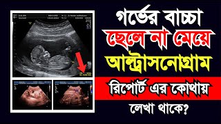 আল্ট্রাসনোগ্রাম রিপোর্ট দেখে নিজে জানুন গর্ভের সন্তান ছেলে না মেয়ে  Ultrasound report in Pregnancy [upl. by Leland184]