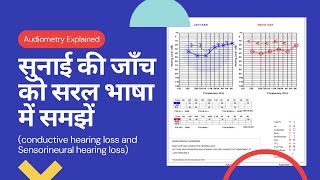 Hearing test explained  सुनाई की जाँच ।Deafness test in Hindi  Pure tone Audiometry interpretation [upl. by Chadd83]