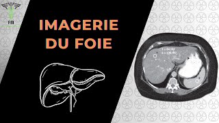 Imagerie Du Foie [upl. by Yrolg]