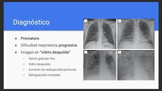 Enfermedad de Membrana Hialina  Neonatología [upl. by Ciaphus576]