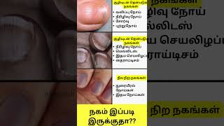 நகம் இப்படி இருக்குதா Nail Disorders in Tamil Shorts intamizh [upl. by Adrahc864]