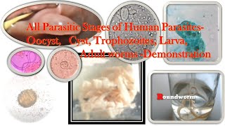 Human Parasites egg larva cyst oocyst trophozoite and adult worms Demonstration [upl. by Kalam]