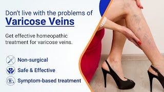 Vericose Veins Treatment  Scelero Therapy vericose veins yt treanding viralvideo [upl. by Quartis]