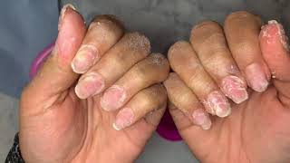 Watch Me Do My Nails  Acrylic Encapsulated Nails  Acrylic Coffin Nails  Soak Off [upl. by Tabbi]