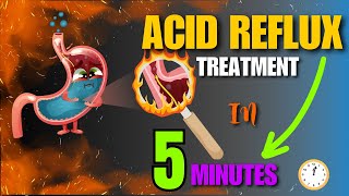 Effective Home Remedies For Acid Reflux  Natural Treatment At Home [upl. by Ocramed598]