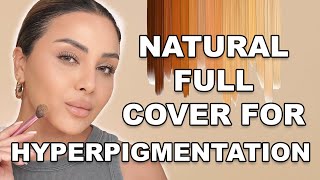 Full Coverage Flawless Makeup for Hyperpigmentation  Nina Ubhi [upl. by Elna]