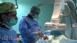 Uterine fibroids embolization Эмболизация маточных артерий [upl. by Audette]