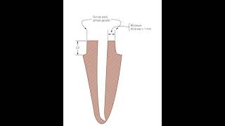 Ferrule effect Dr Mazen Doumani [upl. by Oisor214]