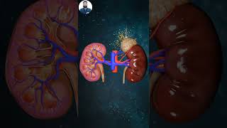 KIDNEY FUNCTION ANIMATION science kidneyhealth kidneydialysis biology biologyislife neet [upl. by Eivol]