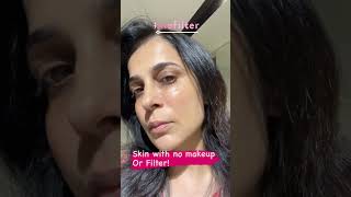 Best Fillers Doctor in India  Dermal Fillers Or Botox Experience  Dr Reema Arora  The Face Clinic [upl. by Nahtnanhoj]