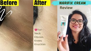 Nigrifix Cream Review  How to get rid of Dark Neck Knees Elbows fast and easy  Malayali Youtuber [upl. by Eyaf391]