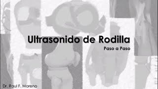 Ultrasonido de Rodilla paso por paso [upl. by Ramoh416]