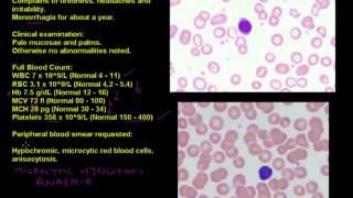 Anaemia in a young woman  Haematology case studies [upl. by Esaele]