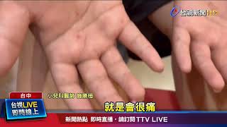 上週台灣就診人數破2萬 兒童腸病毒佔3成 [upl. by Petuu450]