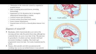 Kanski Clinical Ophthalmology Made Easy  neuroophthalmology 8 [upl. by Htebazileyram]