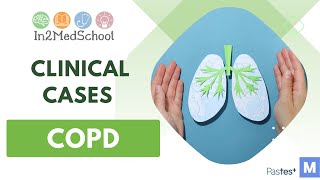 COPD Clinical Case [upl. by Hairehcaz]