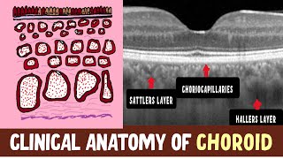 Anatomy Of Choroid  Hallers layer Sattlers layer Choriocapillaris and Clinical Nuggets [upl. by Suivat]