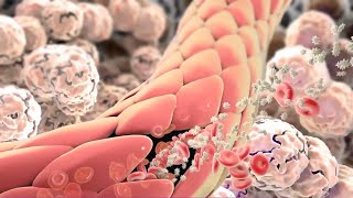 Inflammation Immune Response to Tissue Injury or Infection [upl. by Eldredge]