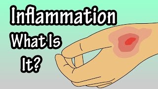 How to Reduce Inflammation Naturally Live Chat Stream Dr Mandell [upl. by Suivatal]