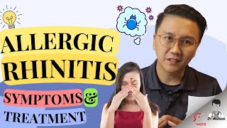 Allergic Rhinitis Symptoms and Treatment Explained [upl. by Adnohsirk973]