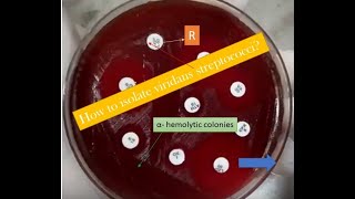 Viridans Streptococci Introduction isolation and pathogenesis [upl. by Westlund]