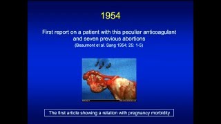 Antiphospholipid syndrome [upl. by Noxas]