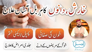 Kharish ka ilaj in Urdu  Acne Pimples Chaiyan  Khoon ki kharabi ka ilaj  Skin Problems Remedies [upl. by Norvil]