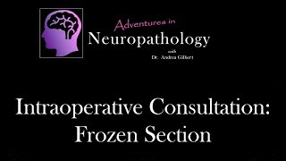 Intraoperative Consultation Frozen Section  Adventures in Neuropathology [upl. by Ansaev]