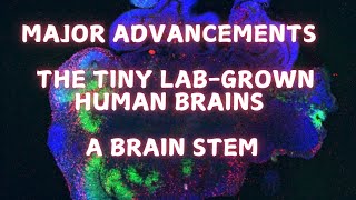 Giving the labgrown brains a brainstem [upl. by Lilybelle]