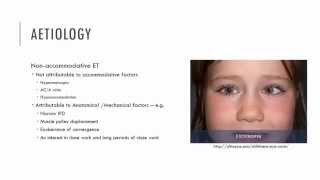 Non Accommodative ET Characteristics [upl. by Bellew]