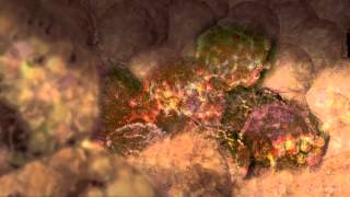 Cancer Cells Undergoing Mitosis [upl. by Kenlay]