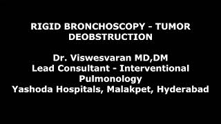 Rigid Bronchoscopic Tumor Debulking  Electrosurgical snaring  Cryoextraction [upl. by Aroz]