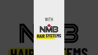 Hair thinning Regain confidence with NMB Hair Systems NMBCanada canadahair canada [upl. by Catherine]