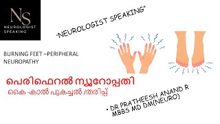 കൈ കാൽ പുകച്ചിൽ BURNING FEETPARESTHESIAPERIPHERAL NEUROPATHYMALAYALAM [upl. by Bui]